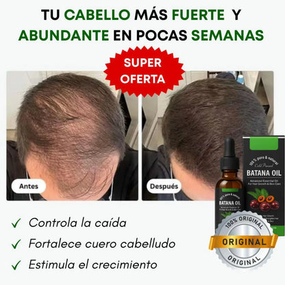 Aceite Batana™ 100% Puro con Romero y Maca Nutritivo Estimula el Crecimiento Capilar y Restaura el Cabello Dañado