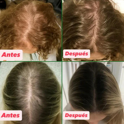 Aceite Batana™ 100% Puro con Romero y Maca Nutritivo Estimula el Crecimiento Capilar y Restaura el Cabello Dañado